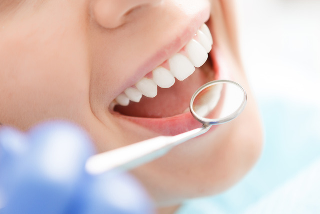 Dental Checkups