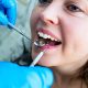 5 Subtle Signs You Might Have a Cavity