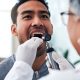Unusual Signs of Oral Cancer That Most People Ignore