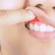 Gum Disease: Early Signs Many Adults Miss & How to Stop It