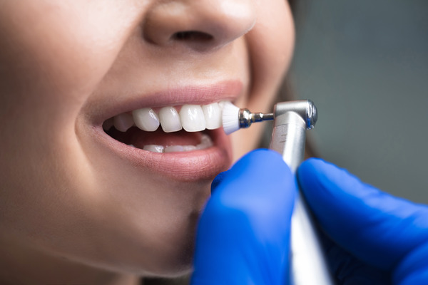 Woman getting her teeth polished